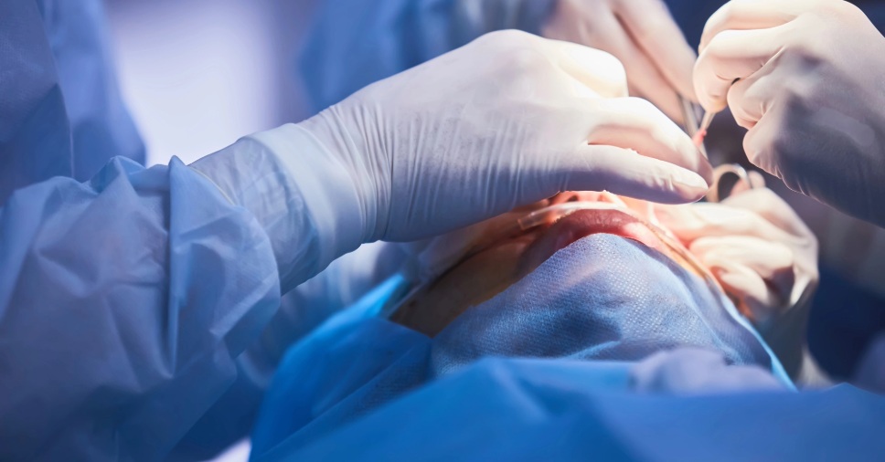 Médicos realizam procedimento cirúrgico para exemplificar os tipos de cirurgias oftalmológicas.